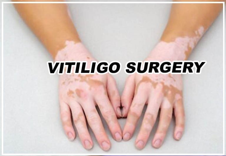 Vitiligo Surgery in Nagpur - Dr. Neha Rathi Cosmetologist