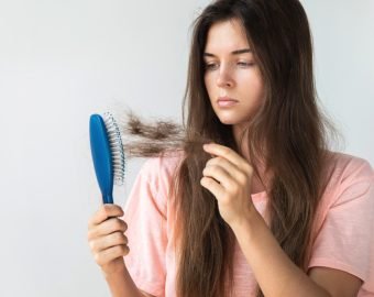 Hair Loss Treatment In Satna