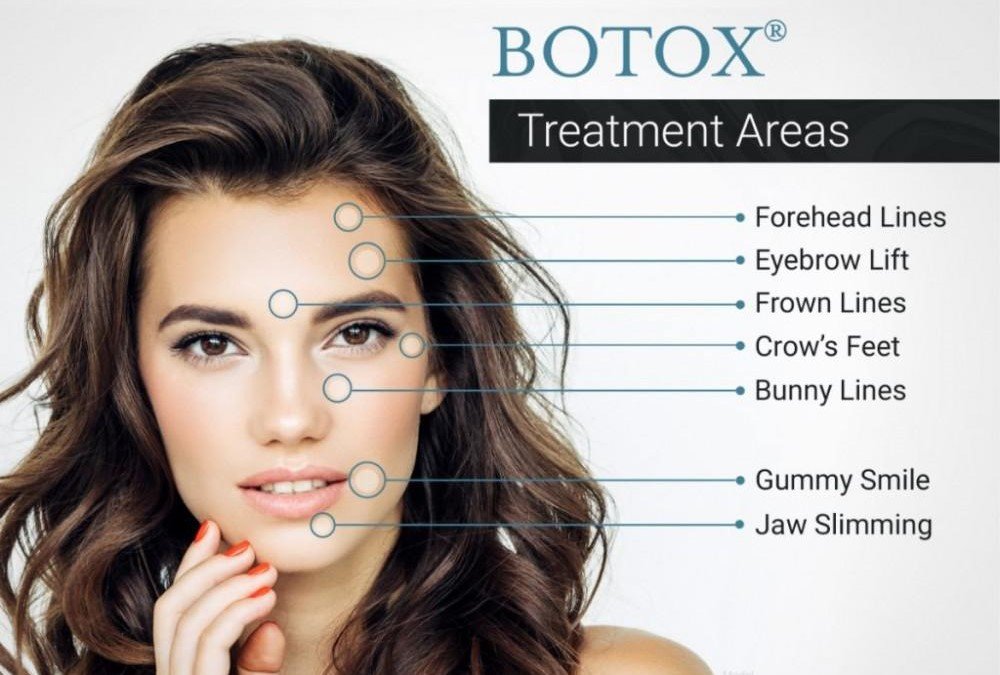 Botox treatment benefits