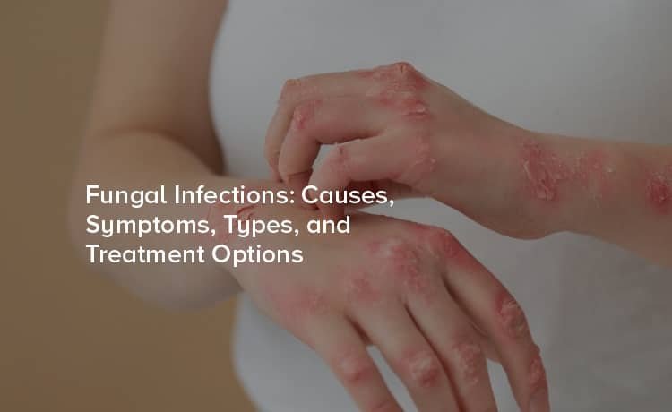 Fungal Infection Treatment In Nagpur