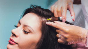 Hair Loss Treatment In Katni