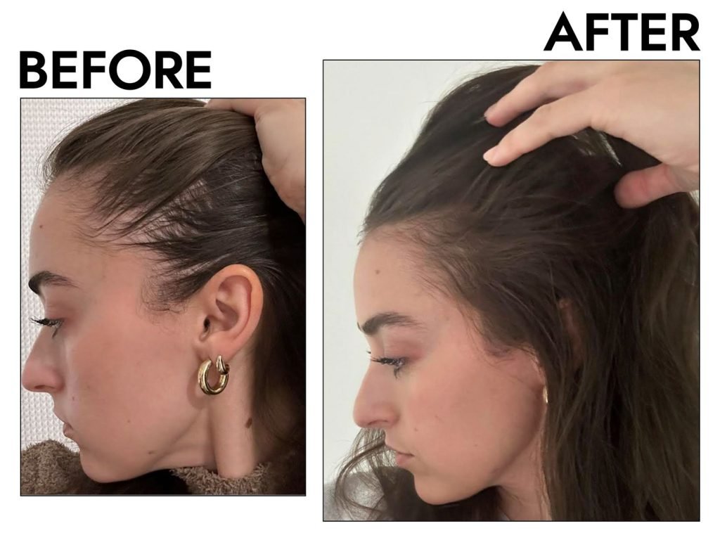 Hair Thinning Treatment Doctor