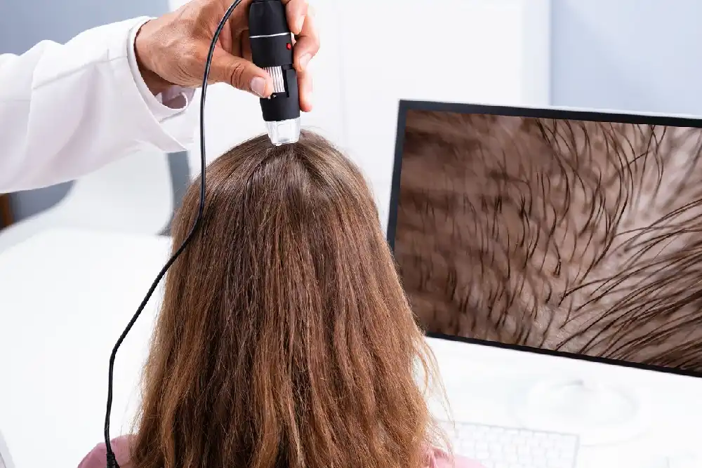 Hair fall specialist In Jafar Nagar