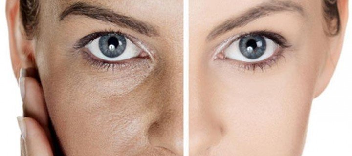 Open Pores Treatment Dermatologist