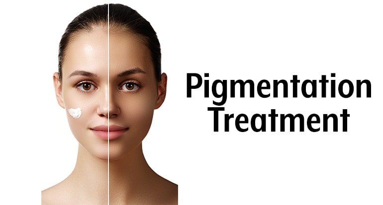 Pigmentation treatment doctor