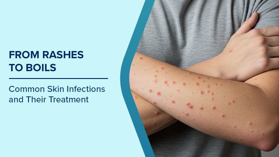 Skin Infection Treatment In Nagpur
