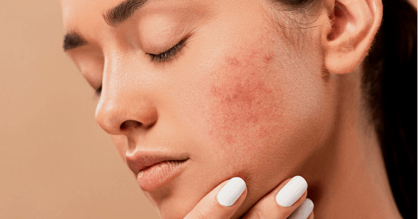 Skin Problem Treatment Near Me