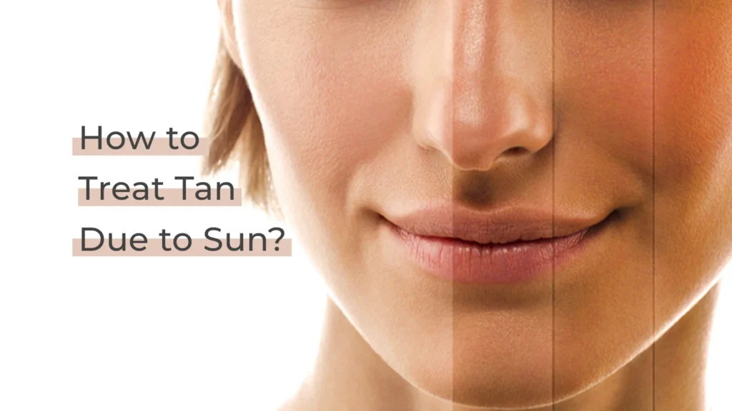 Sun Tan Removal Treatment