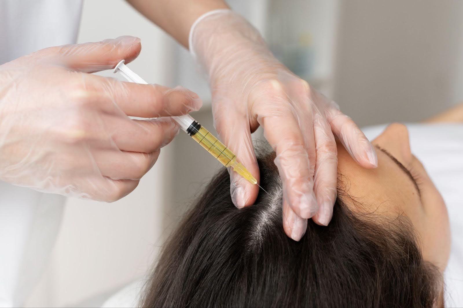 PRP hair treatment specialist